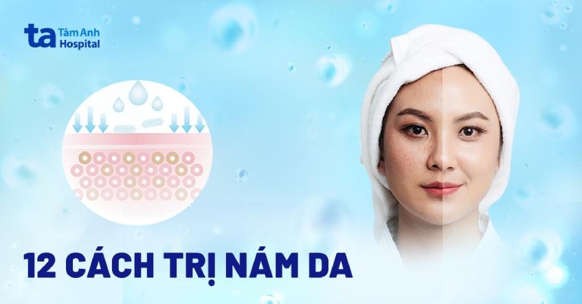 trị giời leo tại nhà