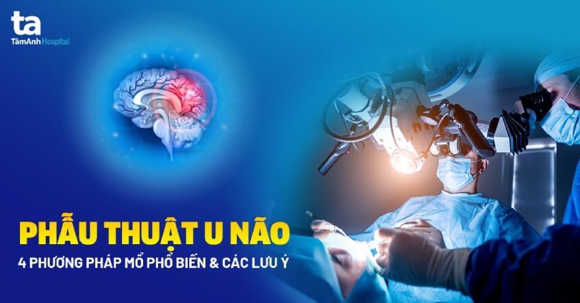 phẫu thuật u não