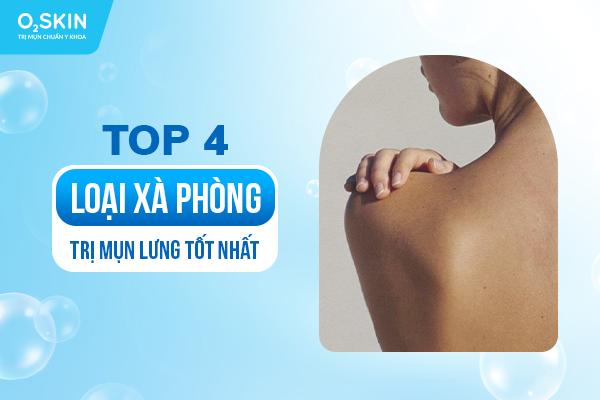 Top 4 loại xà phòng trị mụn lưng tốt nhất