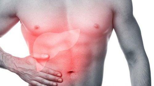 Các bệnh lý liên quan đến gan là nguyên nhân chính dẫn đến vàng da