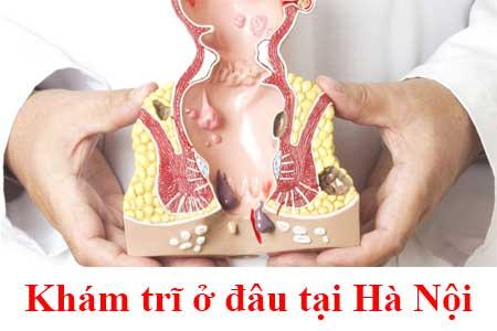 địa chỉ chữa bệnh trĩ ở đâu tốt nhất tại Hà Nội